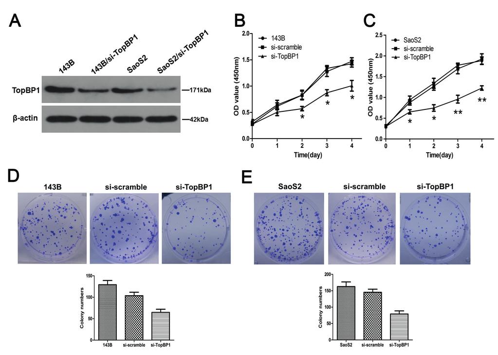 D.-P. Wu, X.-B. Yan, L.-G. Liu, C. Tian, K. Han, H. Zhang, D.-L. Min Figure 2. Silencing of TopBP1 inhibits cell proliferation and colony formation ability of OS cells.
