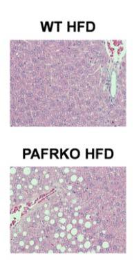 Anti-inflammatory phenotype Steatosis in PAFR KO Insulin Resistance in