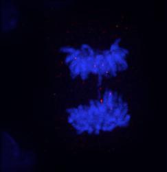 Analysis of anaphase bridges and lagging chromosomes in - depleted HeLa cells.