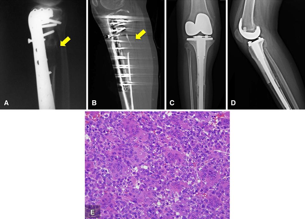 3052 Aponte-Tinao et al. Clinical Orthopaedics and Related Research 1 Fig.