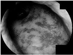 neuropathy Anorectal ultrasound MRI Physical exam Examination of
