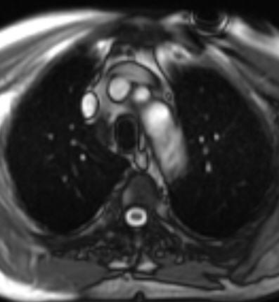 images show the thoracic aortic and brachiocephalic vessel origin