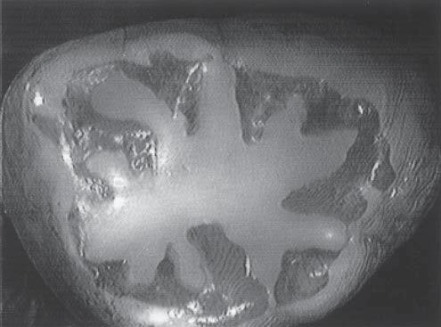 Fig 1a. Occlusal surface of specimen characteristic of group 1: conventional acid etching followed by light-cured sealant. Fig 1b.