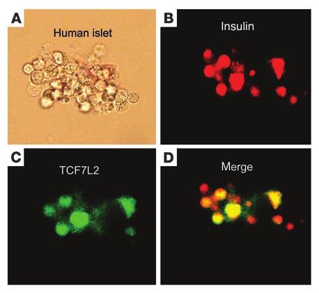 Figure 5 Colocalization of TCF7L2 expression with insulin in pancreatic islets(a D). Double staining of RhodZin (red) (B) and TCF7L2 (green) (C) in human pancreatic islets (yellow) (D).