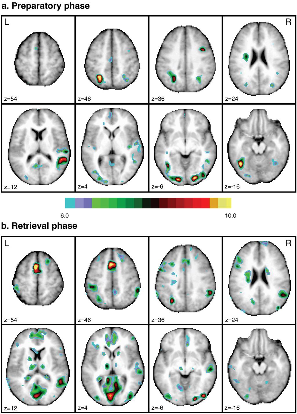 1212 J.S. Phillips et al. / NeuroImage 46 (2009) 1209 1221 Fig. 2.