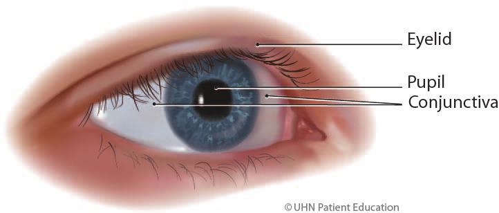 What is strabismus surgery? Your surgeon has recommended strabismus surgery because the muscles in your eyes are causing the eyes not to line up properly when looking at the same object.