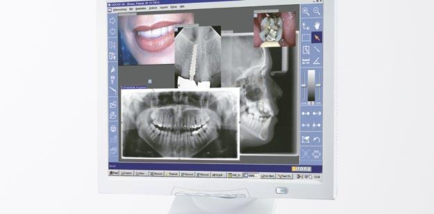 Orthodontics Even more support: The extended arm for orthodontics. ORTHOPHOS XG 5 or ORTHOPHOS XG 3D ready?