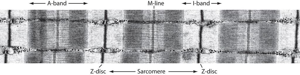 M-line and H-zone I-band, A-band