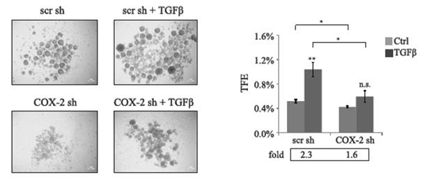 cancer stem cells (Palbociclib) Cyclooxygenase-2 (Cox2) enzymatic pathway: TGFβ regulates Cox2 expression and