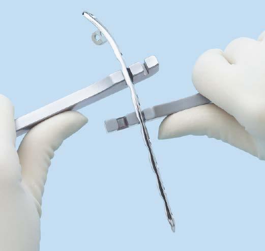 The plate with lateral support allows additional screw insertion through the lateral epicondyle in a lateral-medial direction.