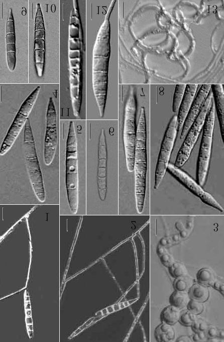 Figs 1-13. Dactyllela shizishanna X.F. Liu & K.Q. Zhang sp. nov. 1-2. Conidiophores. 3. Chlamydospore.