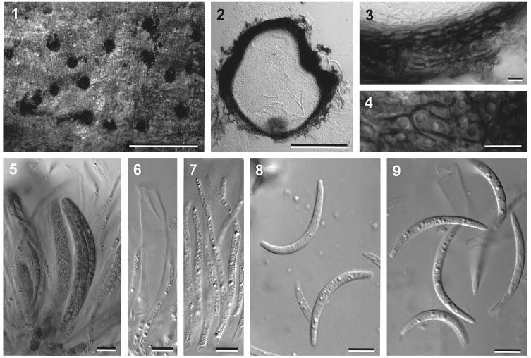 Observations on Cresporhaphis 124 Table 1. The main distinguishing characters amongst Cresporhaphis species with septate ascospores. C. macrospora C. pinicola C.