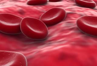What is anemia? Anemia is a blood disorder.