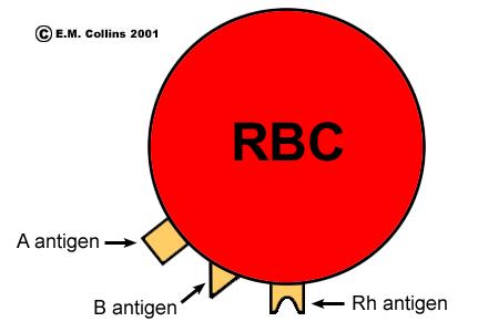 The most common system for typing blood is the ABO system In the ABO system, the presence or absence of type A and type B antigens on red blood cells determines a person s blood type For example: A