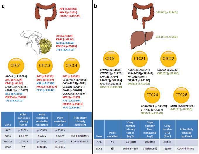 DISTRIBUTION OF MUTATIONS IN PRIMARY TUMOUR, METASTASES AND CTC Colon cancer patient #6 Colon cancer patient #26 Deep targeted sequencing revealed that 17 of 20 private CTC mutations were also