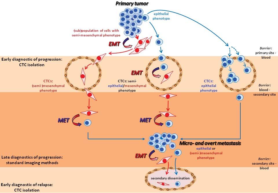 TUMOUR CELL DISSEMINATION, PLASTICITY AND EMT Dormancy > 10 years Cancer Metastasis Rev, Plasticity of disseminating cancer cells in patients with epithelial malignancies, 2012; 31: 673 87.