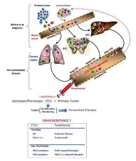 CTC AS LIQUID BIOPSY FOR METASTATIC CELLS The technical challenge: Metastasis evolve many years after primary tumour resection and can harbor unique genomic alterations Biopsy of metastases is an