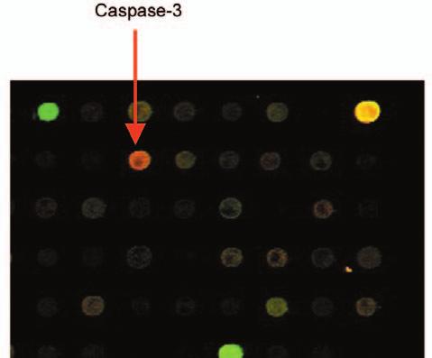 Su et al: Crude Extract of Garlic Induces Apoptosis of Colo 205 Cells and caspase activation could involve two levels (30, 31).