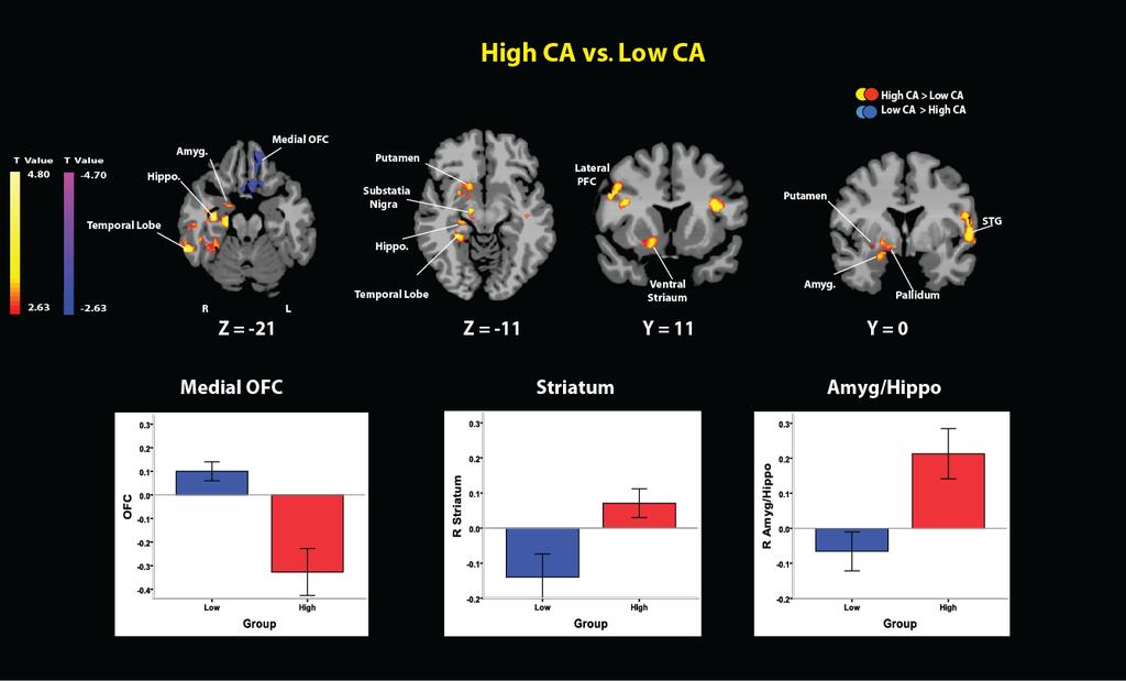 Hi/lo Cumulative Stress Effects on Brain Response to Acute