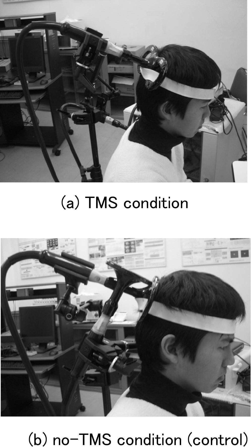 INTERNATIONAL JOURNAL OF APPLIED BIOMEDICAL ENGINEERING VOL.2, NO.2 2009 3 Fig.2: TMs coil was applied over the right posterior parietal cortex.