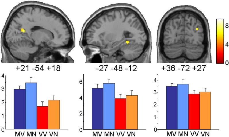 Neuron 912 Figure 5. Brain Regions Preferentially Involved in Memory Retrieval for Scenes Activations were calculated using the main effect of memory: [(Mem/Val Vis/Val) + (Mem/Neu Vis/Neu) (p < 0.