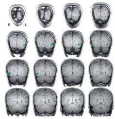 occitpital cortex (Downing et al., 2001) H.