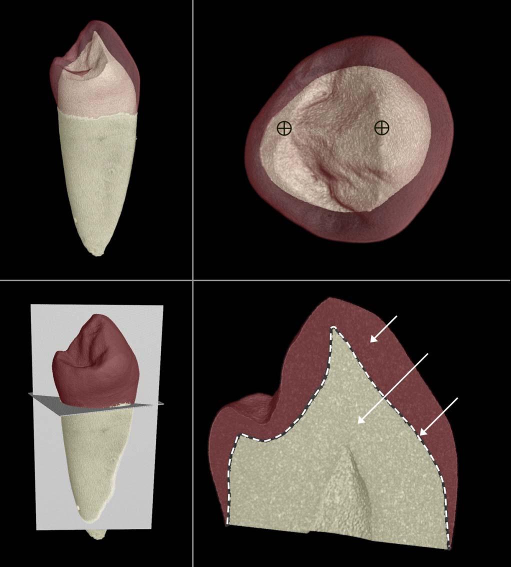 Vol. 118, 2010 ASIAN CANINE AND PREMOLAR ENAMEL THICKNESS 193 Figure 1. Orientation protocol for assessment of enamel thickness from virtual microtomographic planes of section.