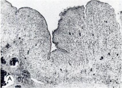 Two types of epithelium are present in this field: respiratory epithelium on the right and flattened cuboidal epithelium on theleft. (H & E, 300X magnification.) (B) High power.