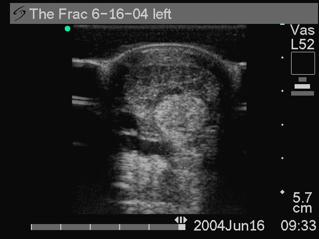 Primary Diagnostic Ultrasonographic Images