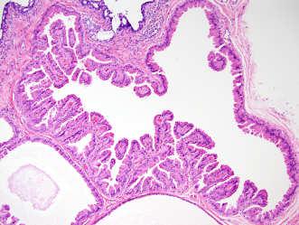 non-apocrine ductal lesions Normal apocrine cells have