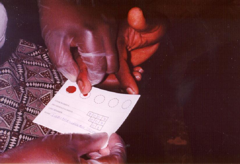 Collection of Samples in the Field for HIV Testing Blood spots from a finger prick were collected on a special filter paper card No names or personal identifiers were