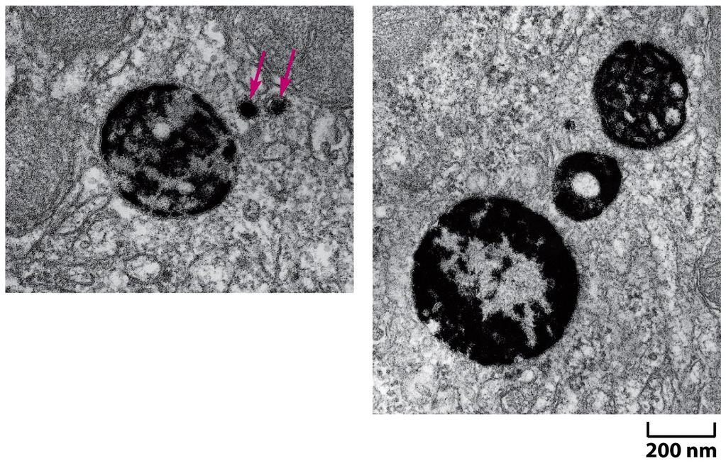 Histochemical visualization of lysosomes Figure 13-37 Molecular Biology of the Cell ( Garland Science 2008) acid phosphatase marker enzyme for lysosomes their diverse morphology reflects variations