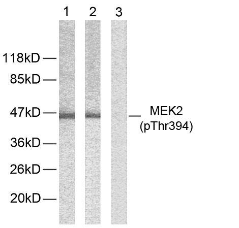 Specificity/Sensitivity: MEK2 (phospho-thr394) antibody detects endogenous levels of MEK2 only when phosphorylated at threonine 394.