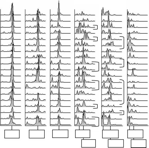 EEG comparisons in early DLB, AD and PDD patients Brain (2008), 131, 690 ^705 701 Table 5 Dominant Frequency (DF), DF variability (DFV), CSA patterns from posterior derivations at 2 years follow-up.