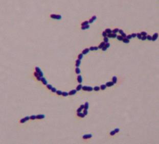 Streptococcus pyogenes (Group A streptococcus) General characteristics Gram-positive Coccus, occurs in chains of varying lengths Catalase negative