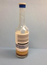 Aerobic / Anaerobic blood culture 10mL Blood each bottle Routine bacterial