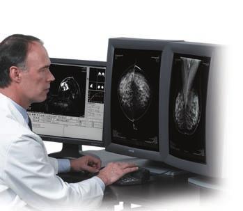 What is Digital Mammography? Mammography is an X-ray of the breast that is the best method of early breast cancer detection.
