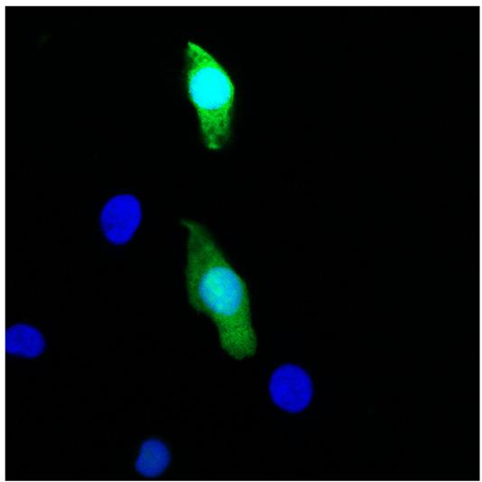CF Dye Annexin V Conjugates and Cell Viability Kits Fluorescent conjugates of Annexin V can be used to stain phosphatidylserine on the surface of apoptotic cells.