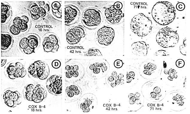 EFFECT OF VIRAL EXPOSURE ON CLEAVAGE AND BLASTOCYST FORMATION 939 viruses. Control cultures were inoculated with an equivalent amount of inactivated interferon.