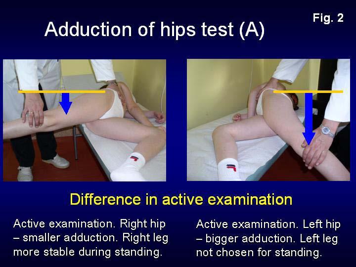 Version I Year 2014 Figure 2 : Test of adduction of