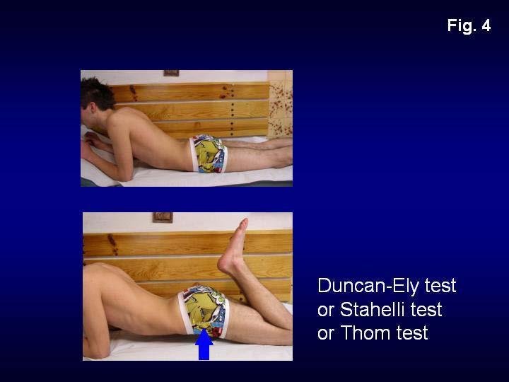 Duncan test or Staheli test or Thom test.