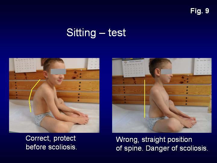 16 Figure 9 : Sitting test. Straight sitting wrong.