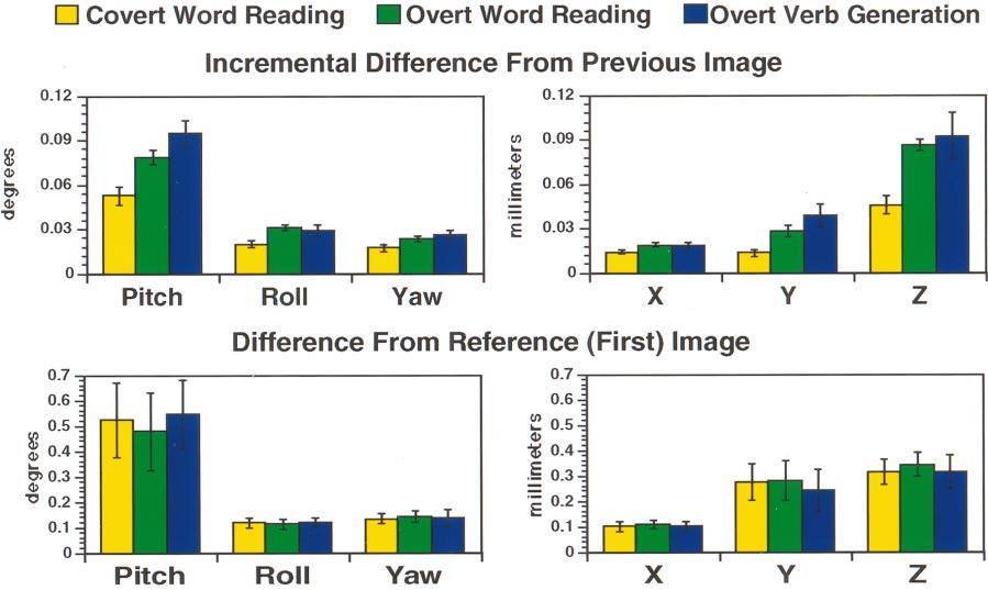 654 BARCH ET AL FIG. 5. Graph illustrating the magnitude of increased estimated movement with overt verb generation and overt word reading as compared to covert word reading.