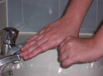 Hand washing should be performed carefully, but avoid rubbing the hands so vigorously that they become tender with repeated washing.