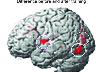 achieved (DeHaene, Reading in the Brain,pp 260) Inferior Frontal Region Phonological area Left anterior inferior