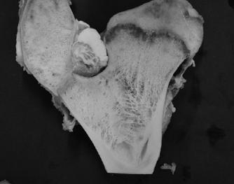 2 μct-imaged of trabecular bone specimen. Specimens of cancellous bone were obtained from the right femur of a bovine.