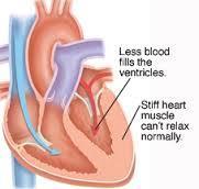 to meet the body s need for blood and O2 Diastolic Heart Failure or HFpEF