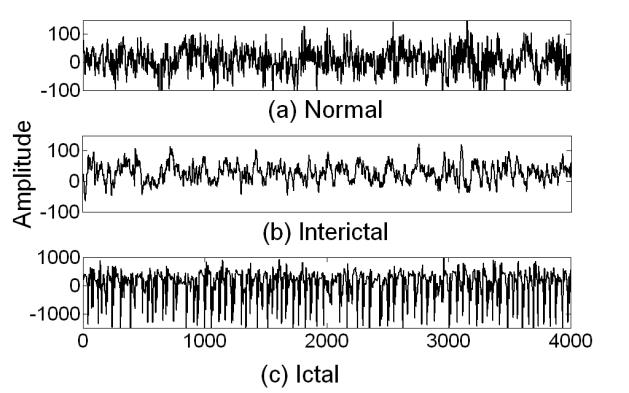 Based on these parameters, the linear classifier classifies the EEG data into any of the above three classes. 2.