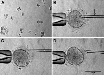 reprogrammed in the cytoplasm of recipient oocytes may not be sufficient enough to initiate and sustain normal clonal embryogenesis (Fulka et al. 1996; Bourc'his et al. 2001; Du F et al. 2002).