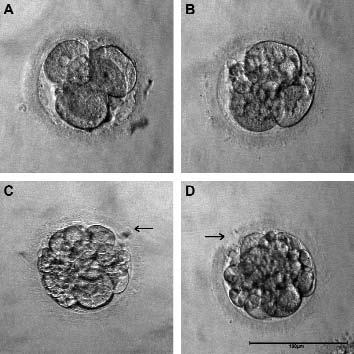 RESEARCH Figure 3. Development of human cloned embryos at approximately 50-55hr post-scnt prior to intrauterine transfer. (A) 4-cell embryo (grade I) showing equally-sized blastomeres.